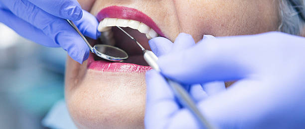 Best Emergency Dental Care for Broken or Chipped Teeth in Zanesville, OH